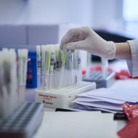 Corona-PCR: Foto 11